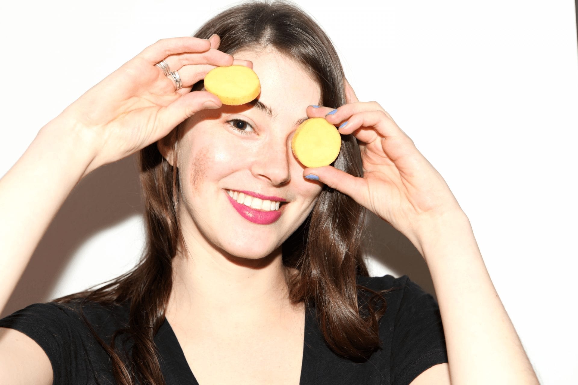 The cause and treatment of dark circles