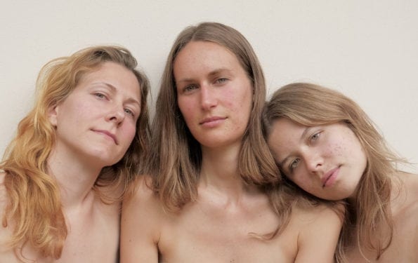 3 Amazingy Frauen — Wie sie selbstbewusst mit ihren Hautproblemen leben