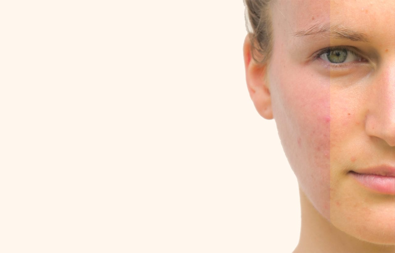 How to Determine Your Undertone Using 4 Simple Tricks | Amazingy Magazine