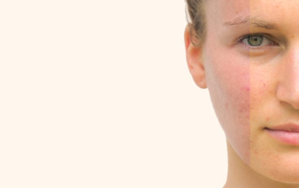 How to Determine Your Undertone Using 4 Simple Tricks | Amazingy Magazine