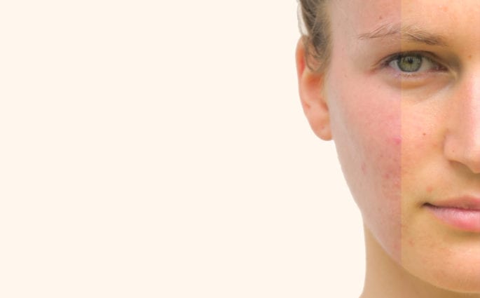 How to Determine Your Undertone Using 4 Simple Tricks | Amazingy Magazine