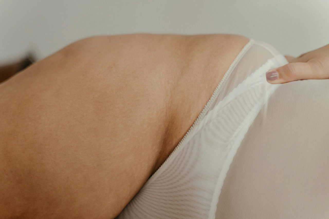 A Photo of a Woman's Hip by Ron Lach via Pexels - Let's Talk Cellulite - Amazingy Magazine
