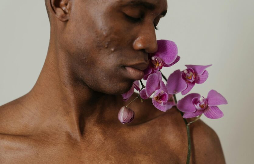 What’s My Skin Type? Understanding Acne-Prone Skin