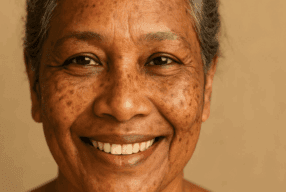 What’s My Skin Type? — Understanding Hyperpigmented Skin